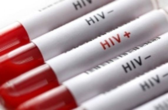 Aumento de VIH en Chile